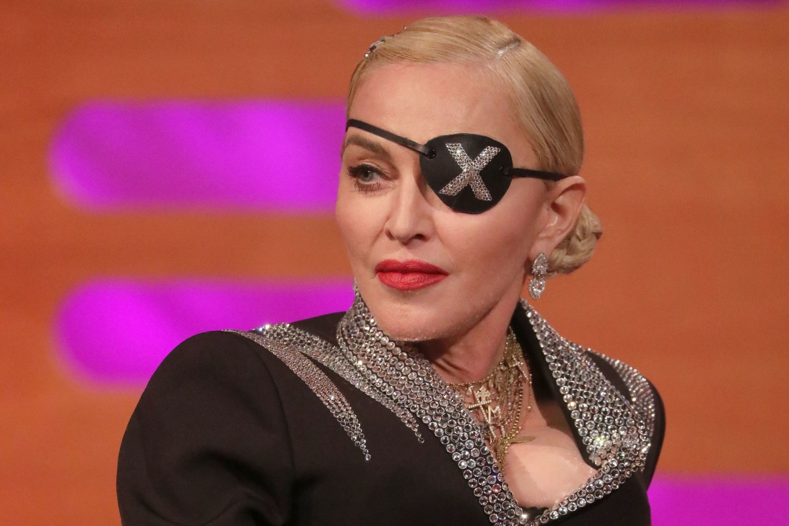 MADONNA CANCELS TOUR DATES ON MEDICAL ADVICE